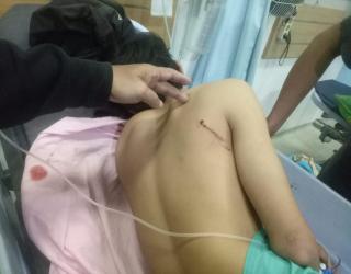 Lagi Asyik Pasang Spanduk HUT RI, Remaja 16 Tahun di Belawan Ditembak OTK